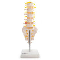 Lumbar Vertabrae with Sacrum/Coccyx/Herniated Disc
